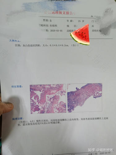 宫颈病变多久复查一次 宫颈病变多久复查一次