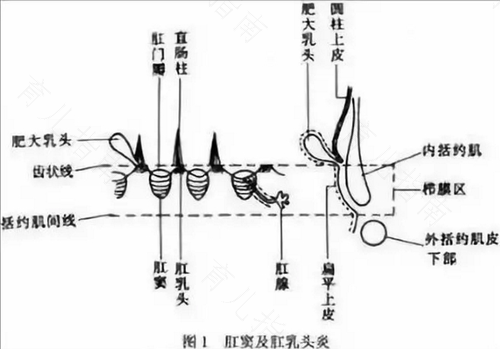 先天性无肛门会遗传吗 先天性无肛门会遗传吗