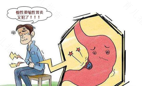 肠胃不好有什么办法吗 肠胃不好有什么办法吗