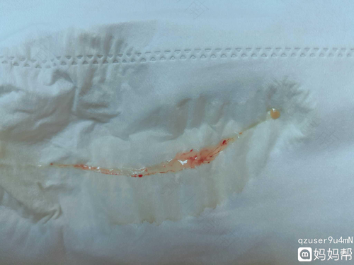 排卵期有腥味怎么回事