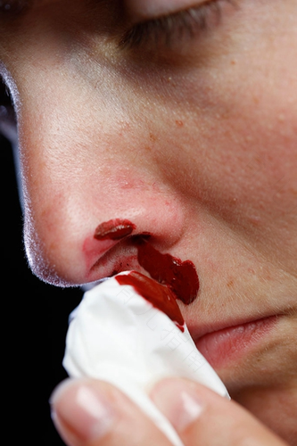 女人鼻子冒血可能什么原因