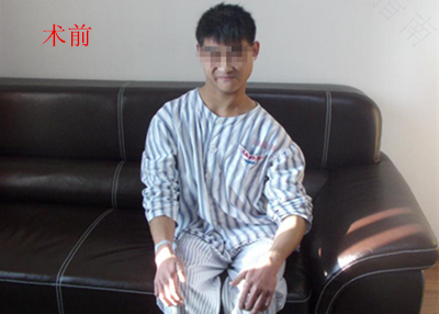 脑瘫有智力正常的吗 脑瘫有智力正常的吗