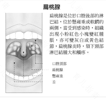 咽喉痛怎么办简单方法 咽喉痛怎么办简单方法