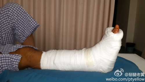 脚跟韧带拉伤怎么办恢复快 脚跟韧带拉伤怎么办恢复快