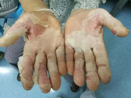 男人身体热是怎么回事 男人身体热是怎么回事