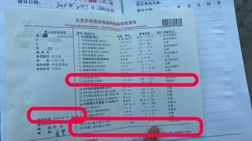 贫血严重需要输液吗 贫血严重需要输液吗