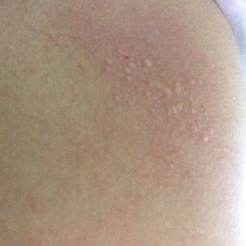 晚上睡觉时身上痒 晚上睡觉时身上痒