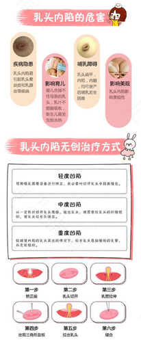 先天乳头内陷要怎么解决