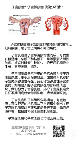 子宫分左右吗? 子宫分左右吗?