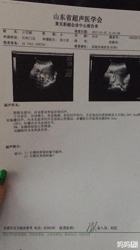 绝经了还要做妇科检查吗 绝经了还要做妇科检查吗
