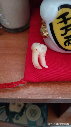 拔完智齿缝线不拆会怎么样