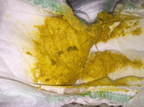 宝宝大便有油花是怎么回事