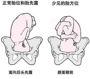 子宫糜烂b超能检查出来吗 子宫糜烂b超能检查出来吗