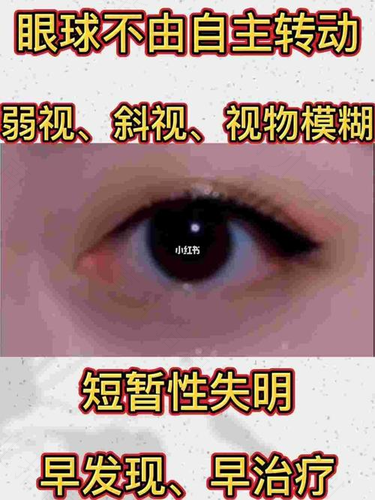 猫咪眼球震颤是怎么回事 猫咪眼球震颤是怎么回事