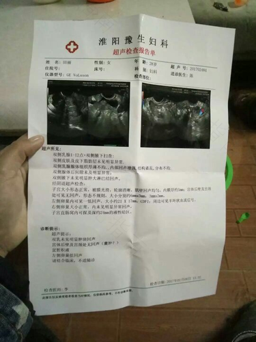 输卵管炎阴超能检查出来吗 输卵管炎阴超能检查出来吗