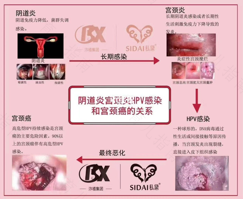 产后子宫感染怎么办 产后子宫感染怎么办