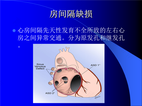缺钙会导致嗜睡吗 缺钙会导致嗜睡吗