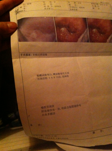 做了宫颈活检后多久可以洗澡 做了宫颈活检后多久可以洗澡