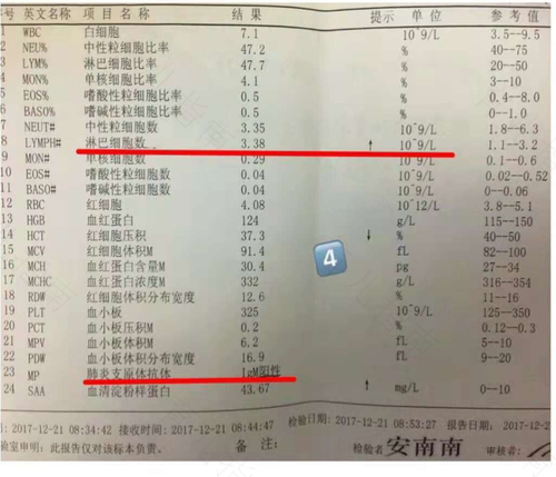 细菌感染怎么看血常规 细菌感染怎么看血常规