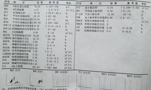 缺失型a地贫严重吗