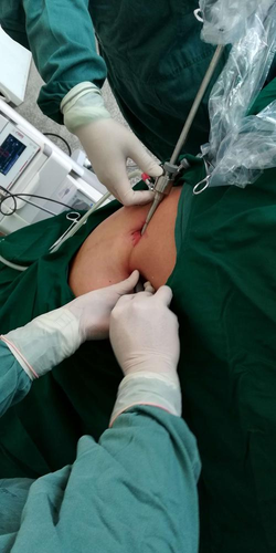 疝气手术后的注意事项 疝气手术后的注意事项