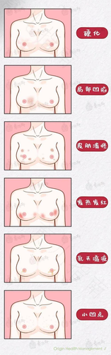 乳头变红是怎么回事 乳头变红是怎么回事