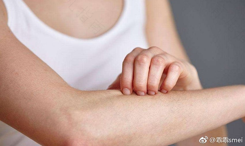 手一到冬天就过敏怎么办 手一到冬天就过敏怎么办