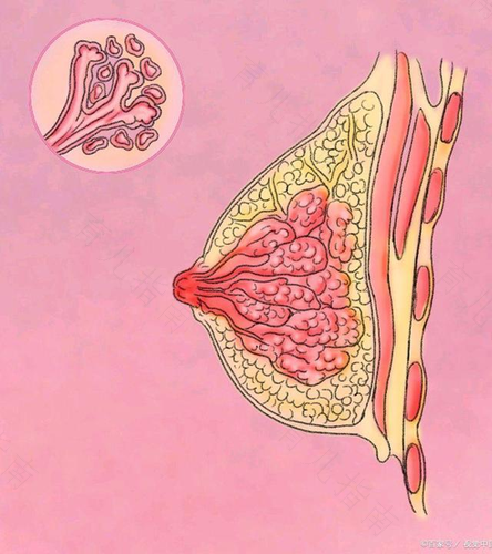 女性乳腺结节是什么原因造成的
