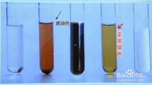 一直尿黄是怎么回事男性 一直尿黄是怎么回事男性