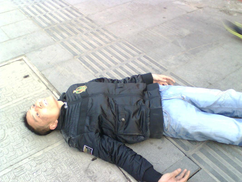 羊癫疯的症状是什么样子 羊癫疯的症状是什么样子