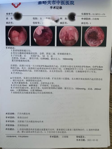 一般什么病需要做宫腔镜 一般什么病需要做宫腔镜
