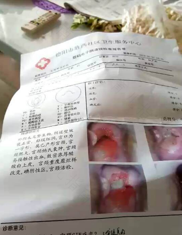 hpv宫颈病变的症状 hpv宫颈病变的症状