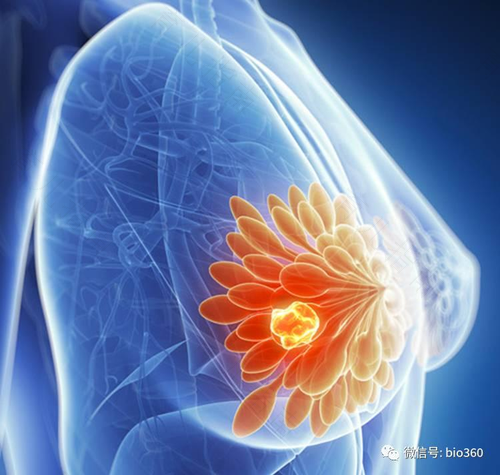 乳腺癌复发转移怎么办还能治愈吗 乳腺癌复发转移怎么办还能治愈吗