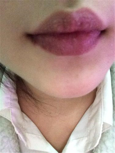 感冒嘴巴特别干怎么办 感冒嘴巴特别干怎么办