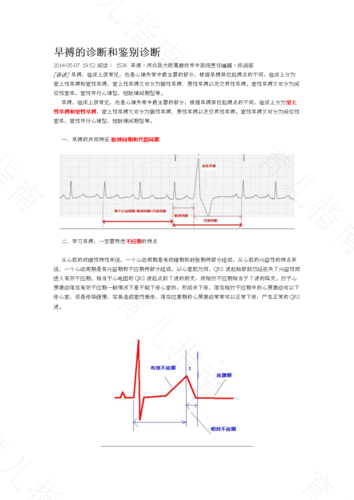 心脏早搏心律不齐是怎么回事 心脏早搏心律不齐是怎么回事