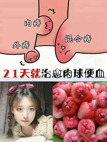 痔疮好了有个肉球严不严重 痔疮好了有个肉球严不严重