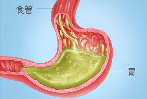 胃每天都烧心怎么回事 胃每天都烧心怎么回事