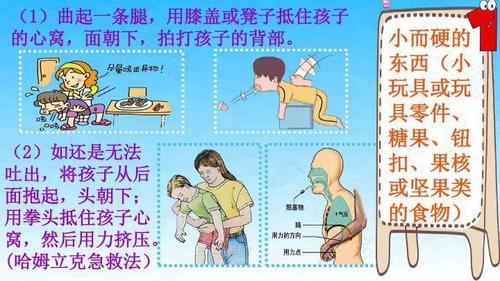 儿童意外受伤 紧急处理小知识