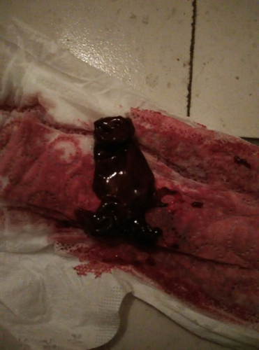 绝经一年了又有点血了怎么了 绝经一年了又有点血了怎么了