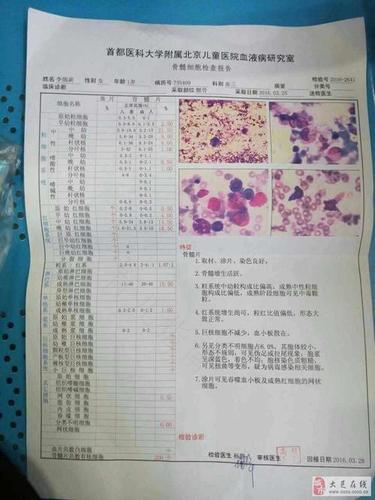 血液里有eb病毒是什么病 血液里有eb病毒是什么病