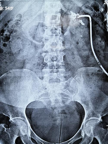 造影剂多久可以打一次