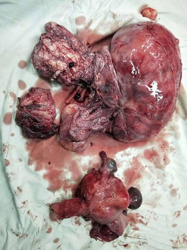 子宫里面为什么会长囊肿 子宫里面为什么会长囊肿