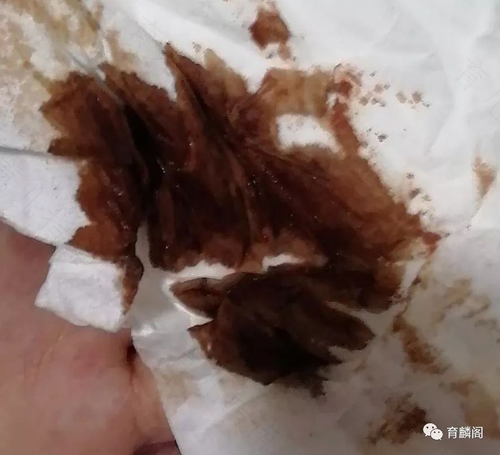 白带呈灰黑色是怎么回事