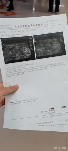 右侧乳腺实性结节4a类是什么意思 右侧乳腺实性结节4a类是什么意思