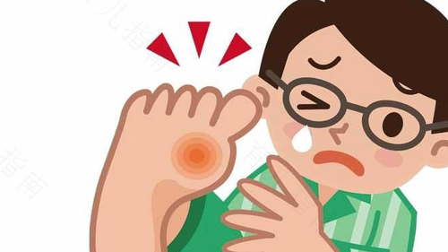 脚上痛风怎么缓解疼痛 脚上痛风怎么缓解疼痛