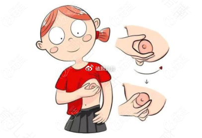 乳头老是凸起怎么回事 乳头老是凸起怎么回事