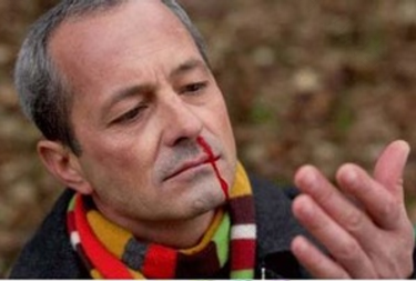 鼻子右边流鼻血是怎么回事 鼻子右边流鼻血是怎么回事