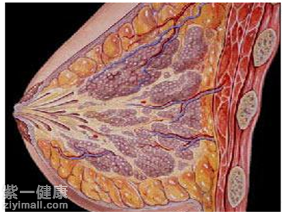 乳腺小叶增生腋下淋巴结肿大怎么办 乳腺小叶增生腋下淋巴结肿大怎么办