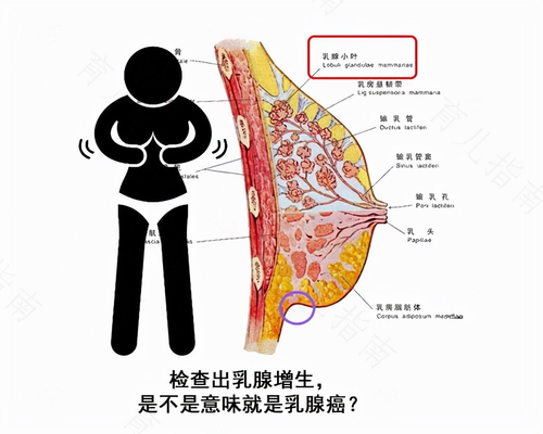 乳腺小叶增生怎么按摩乳房 乳腺小叶增生怎么按摩乳房