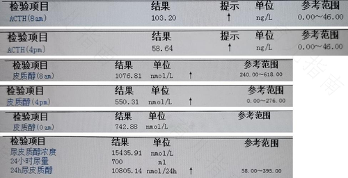 性激素检查是查什么病 性激素检查是查什么病